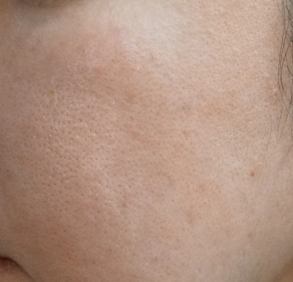 before_image