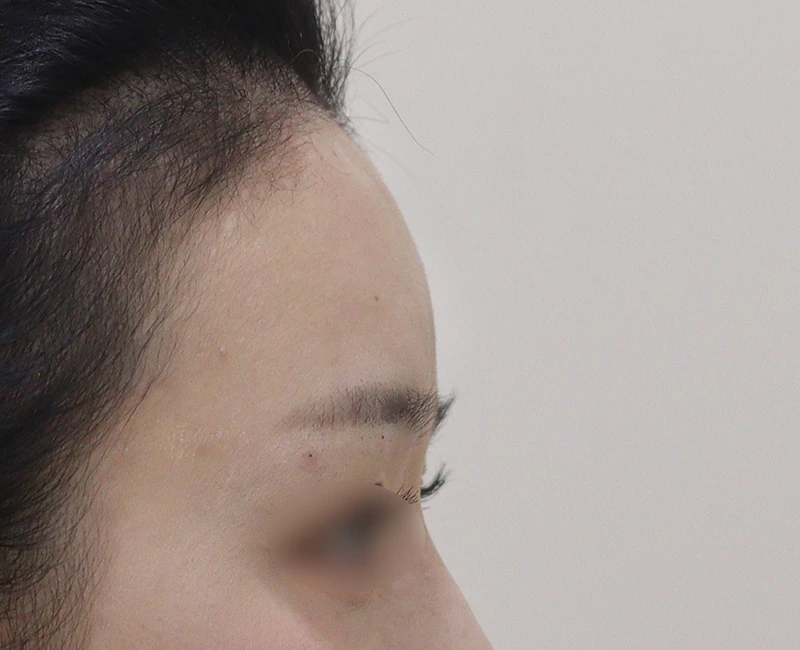 before_image
