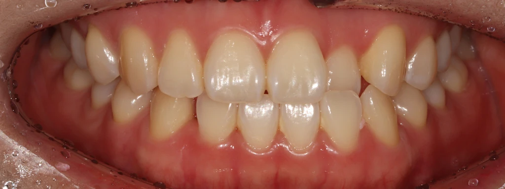 before_image