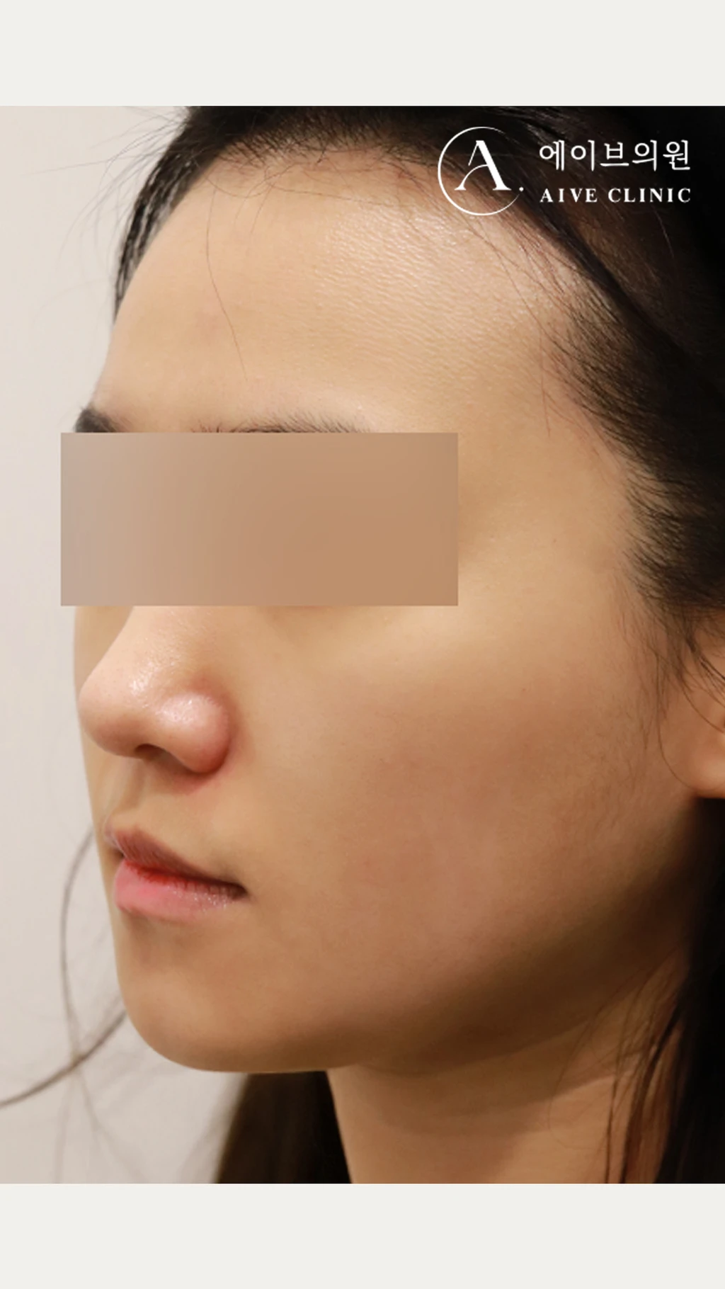 before_image