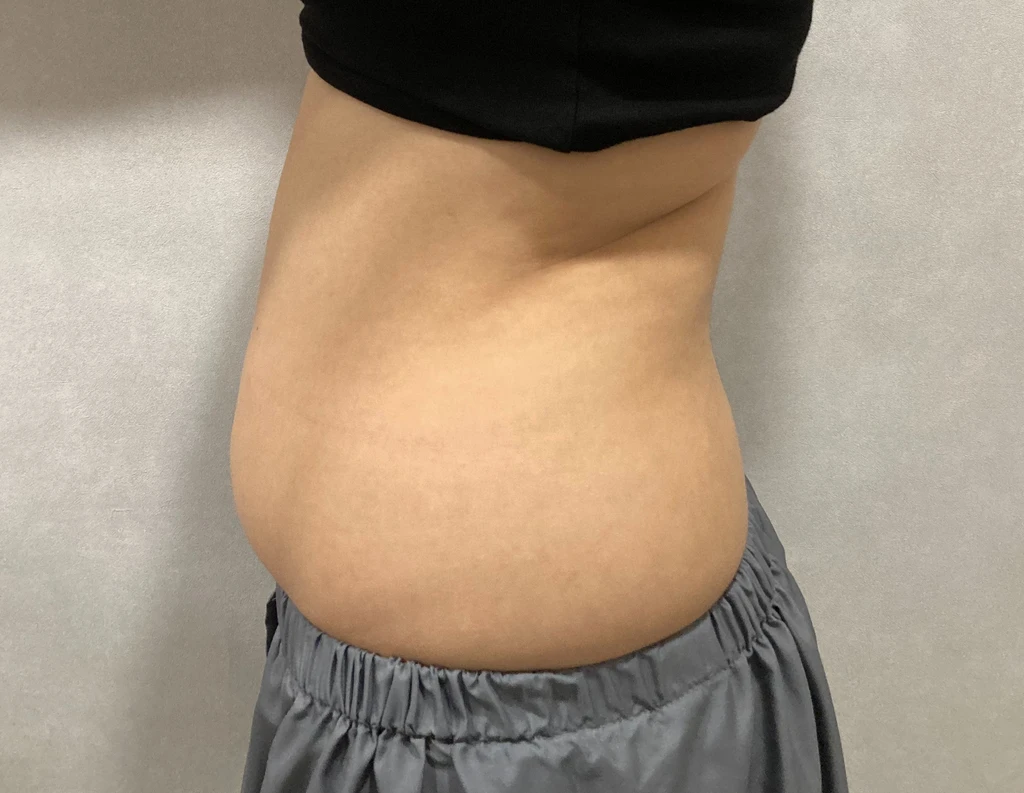 before_image