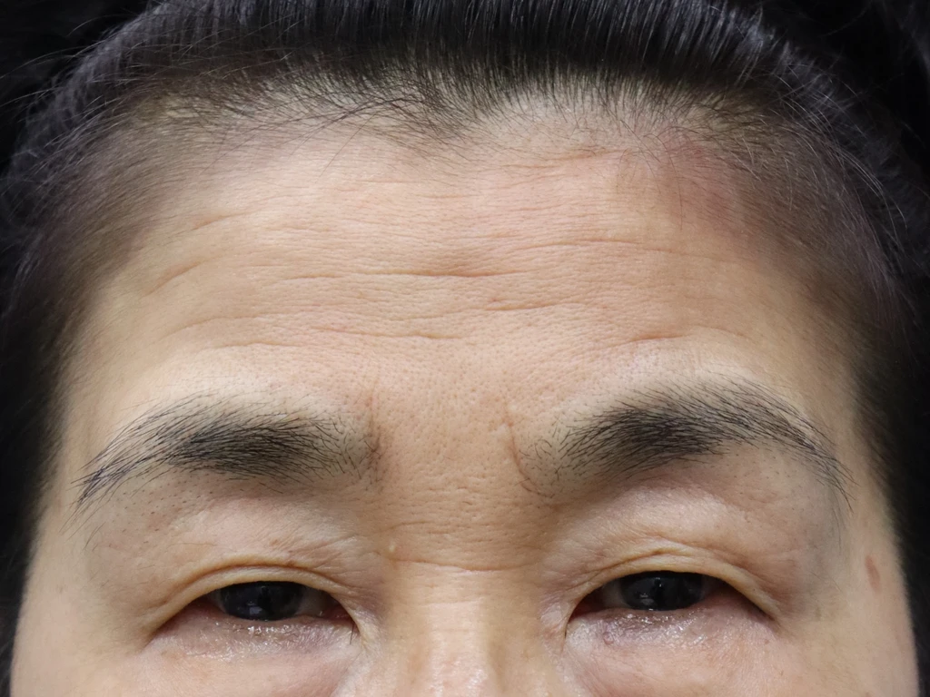 before_image