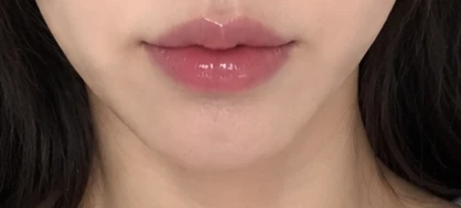 before_image