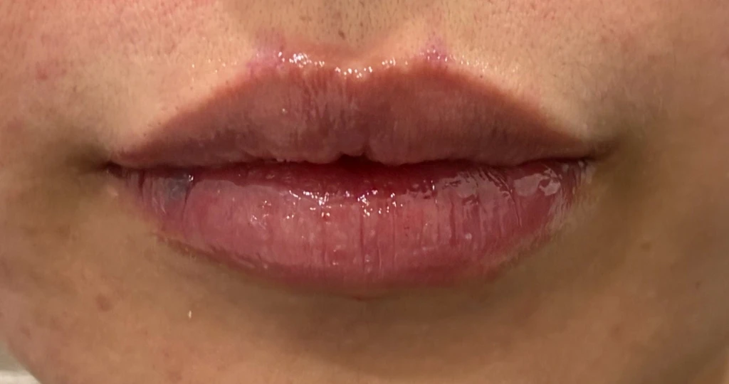 before_image