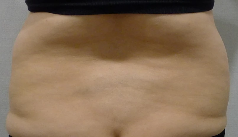 before_image