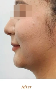 before_image
