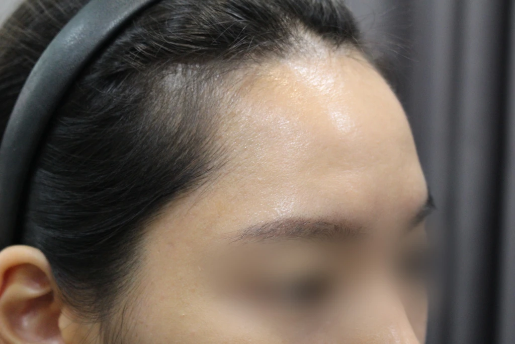 before_image