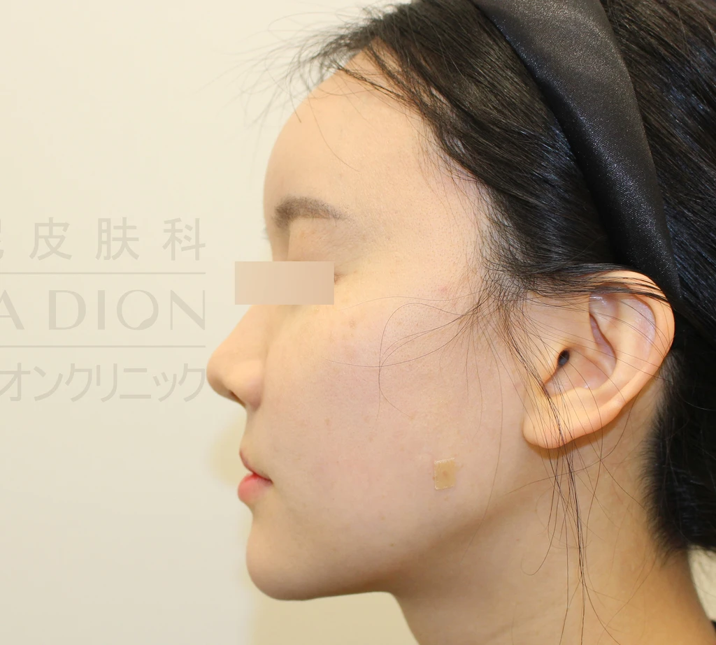 before_image