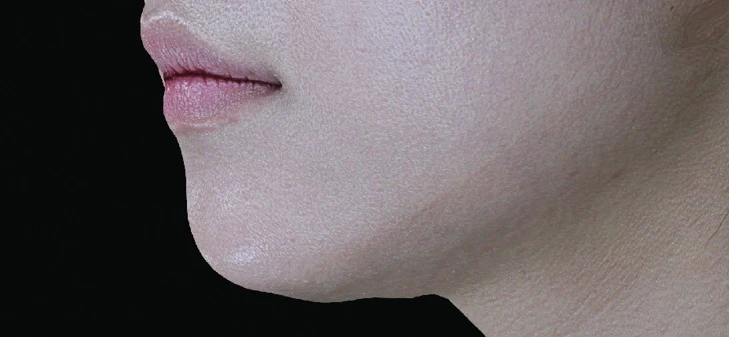 before_image