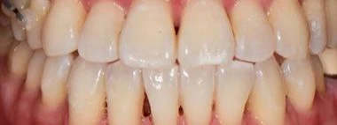 before_image