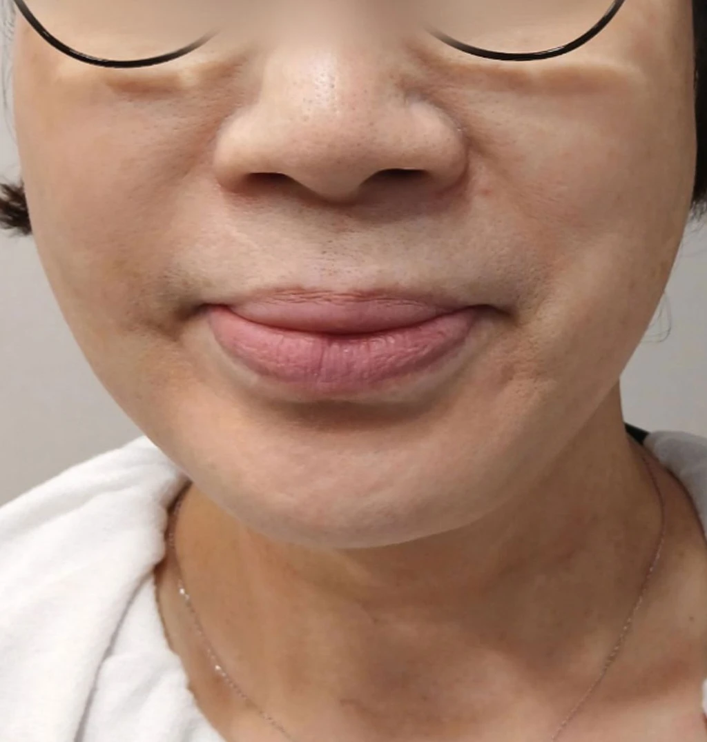 before_image