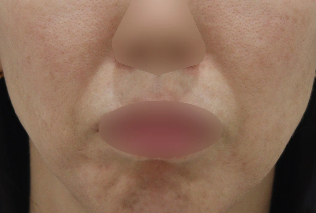 before_image