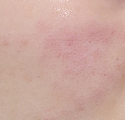 before_image