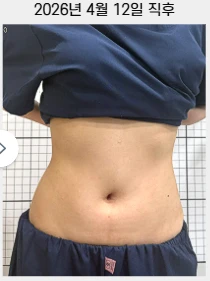 before_image