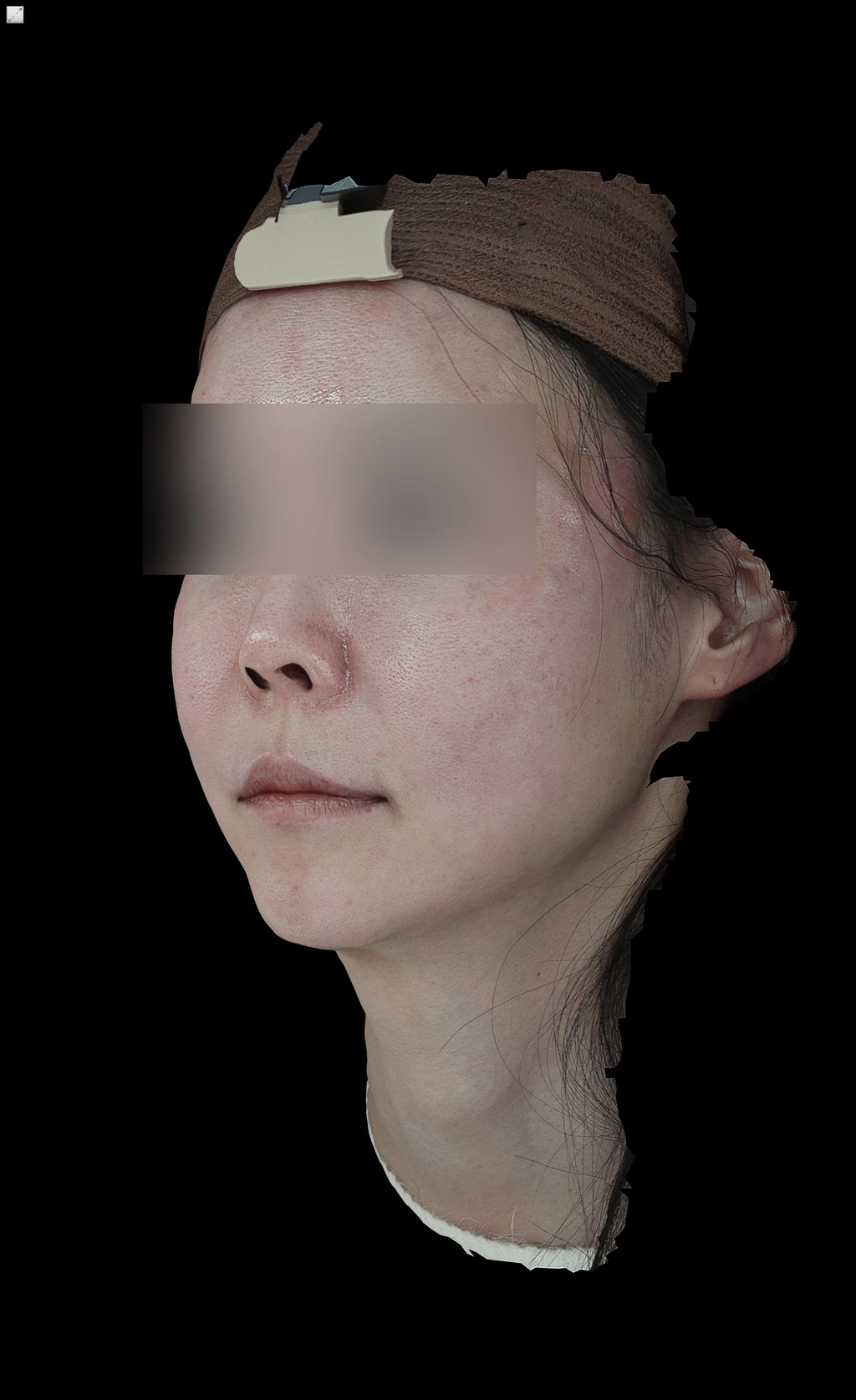 before_image