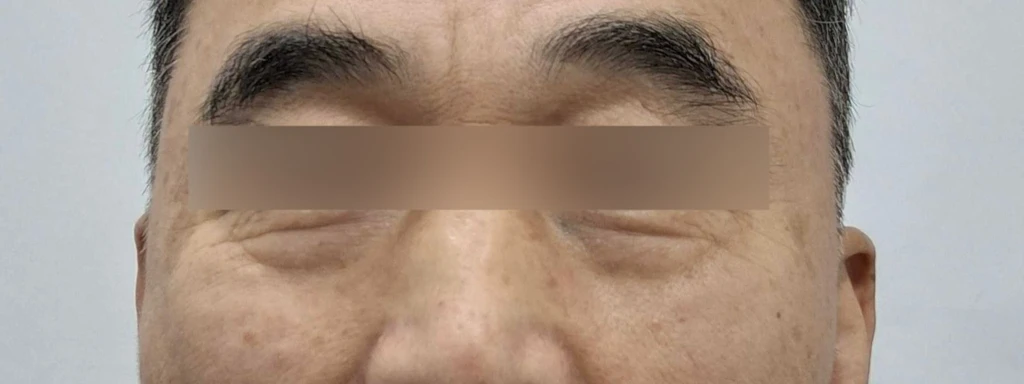 before_image