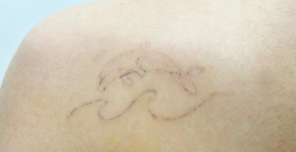 before_image
