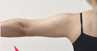 before_image