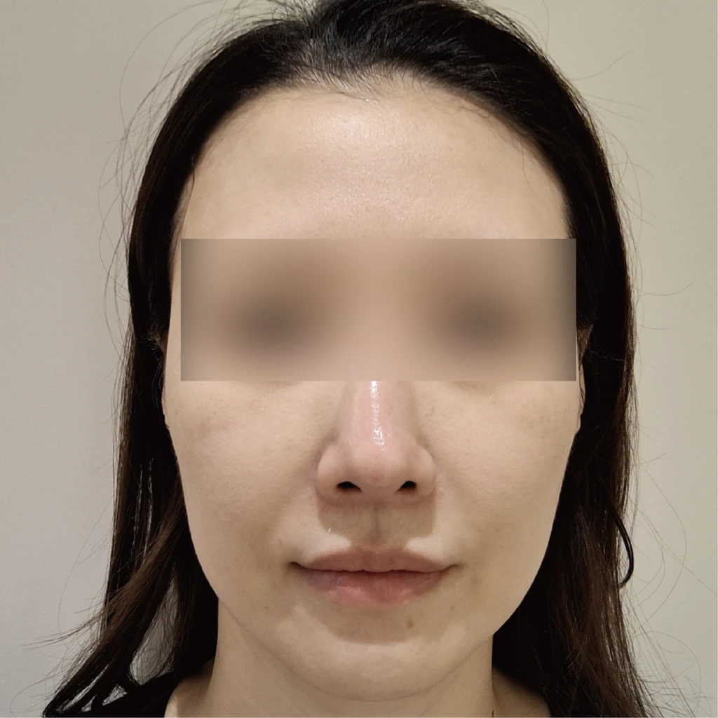 before_image
