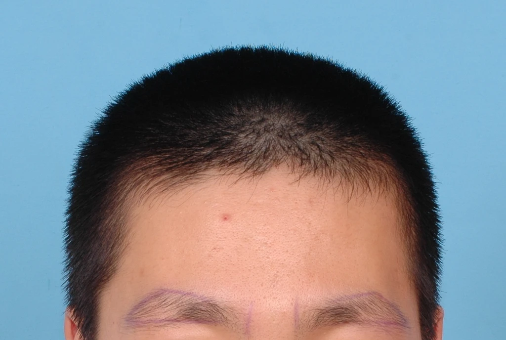 before_image