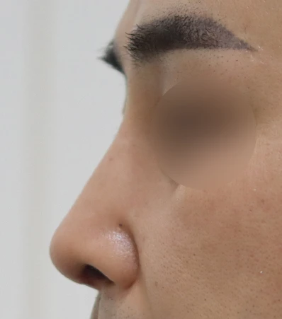 before_image
