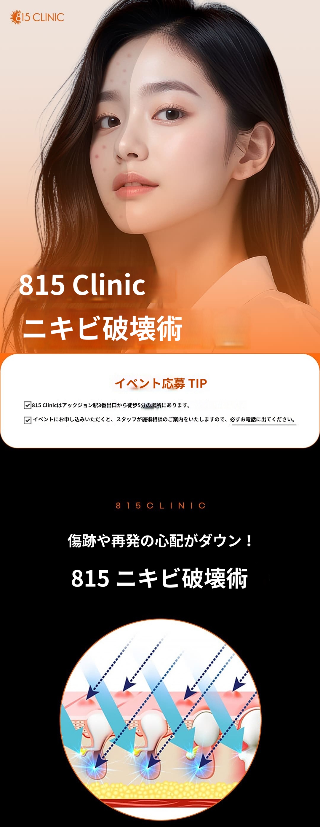 ニキビ撃退 割引、価格、レビュー、ビフォーアフター、効果 by 815