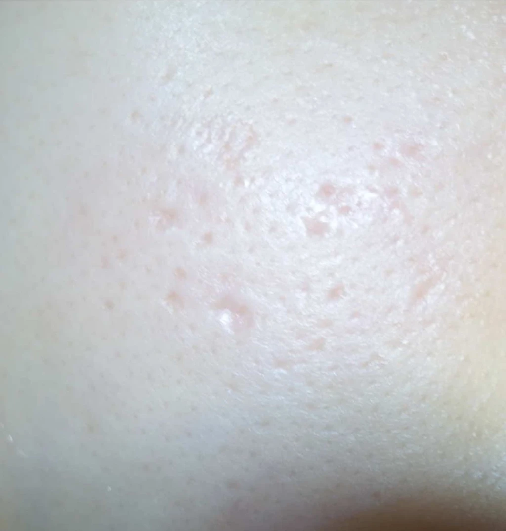 before_image