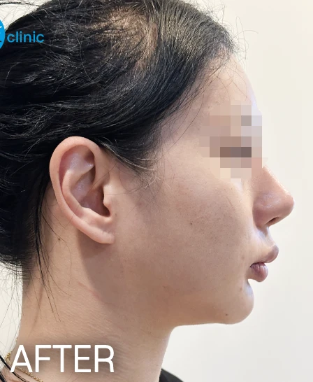 before_image