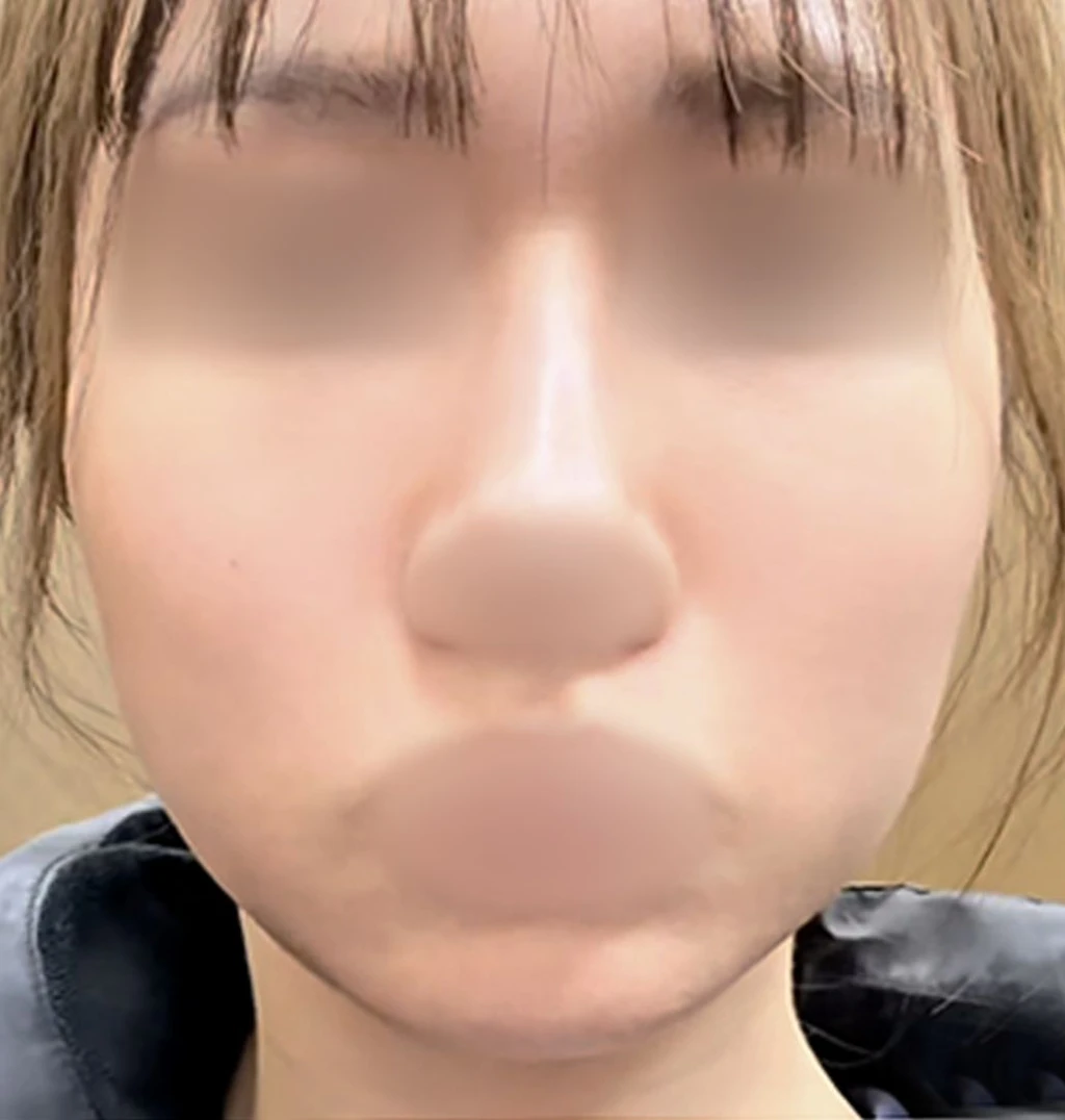 before_image
