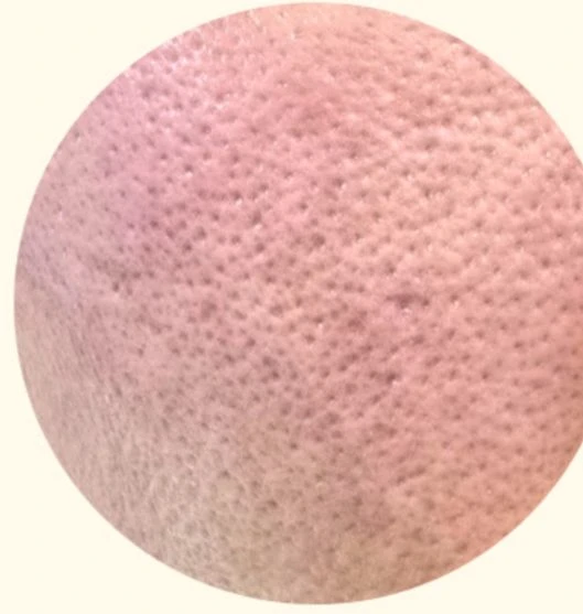 before_image