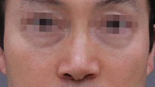 before_image