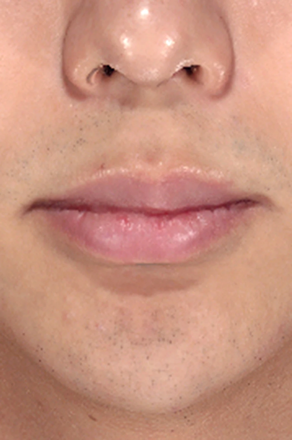 before_image
