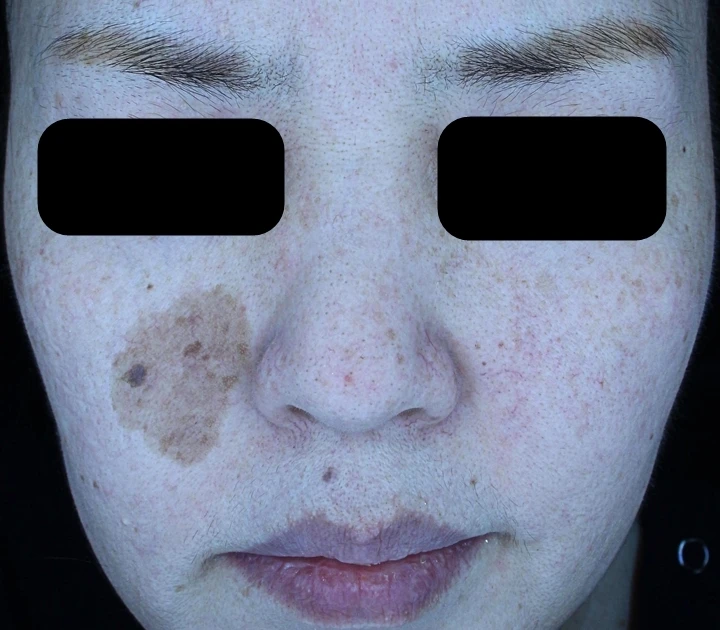 before_image