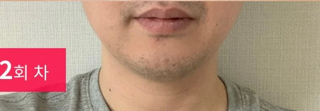 before_image