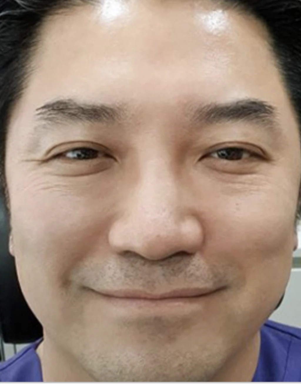 before_image