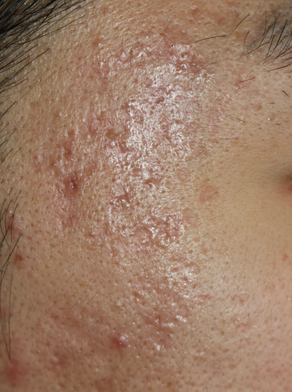 before_image