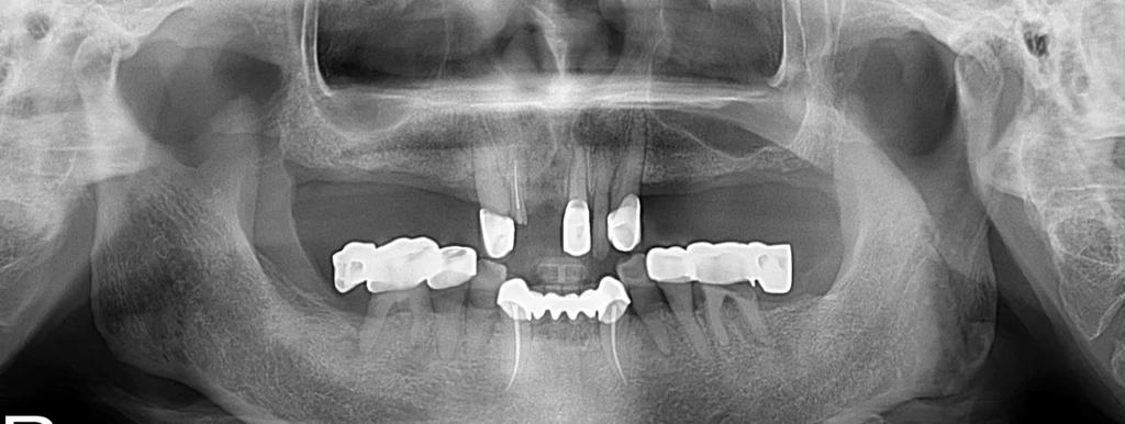 before_image