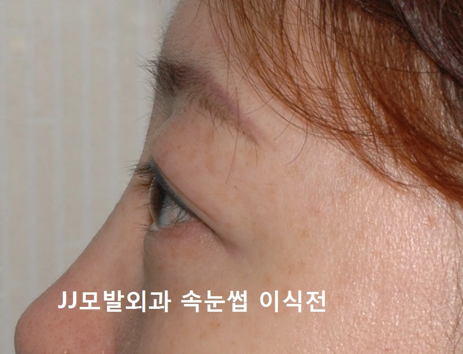 before_image