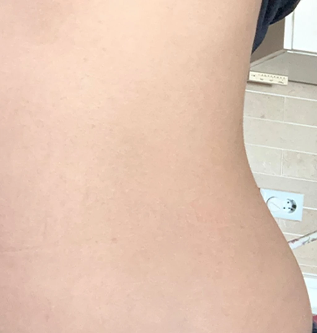 before_image