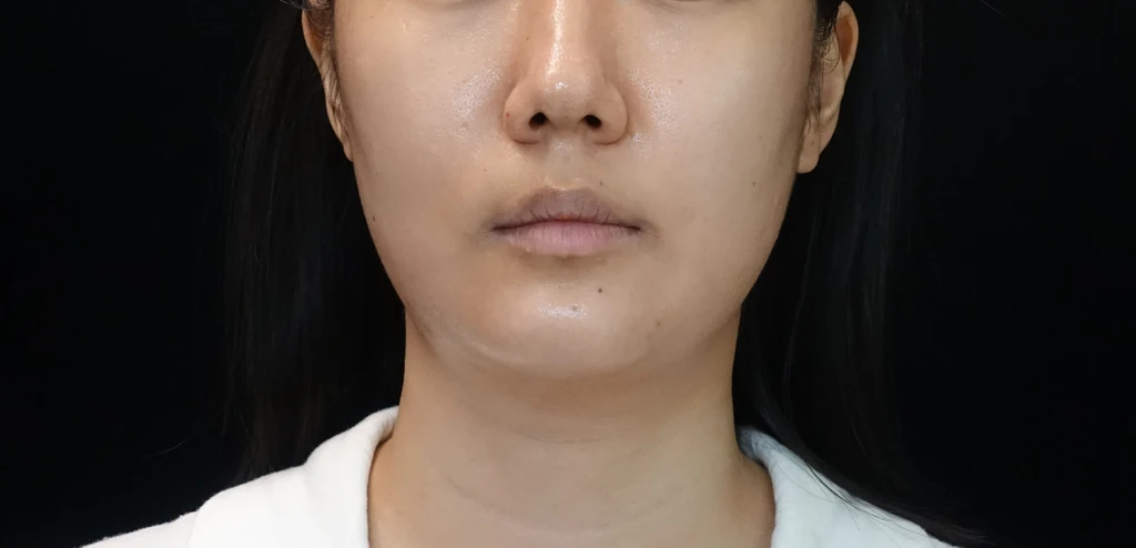 before_image
