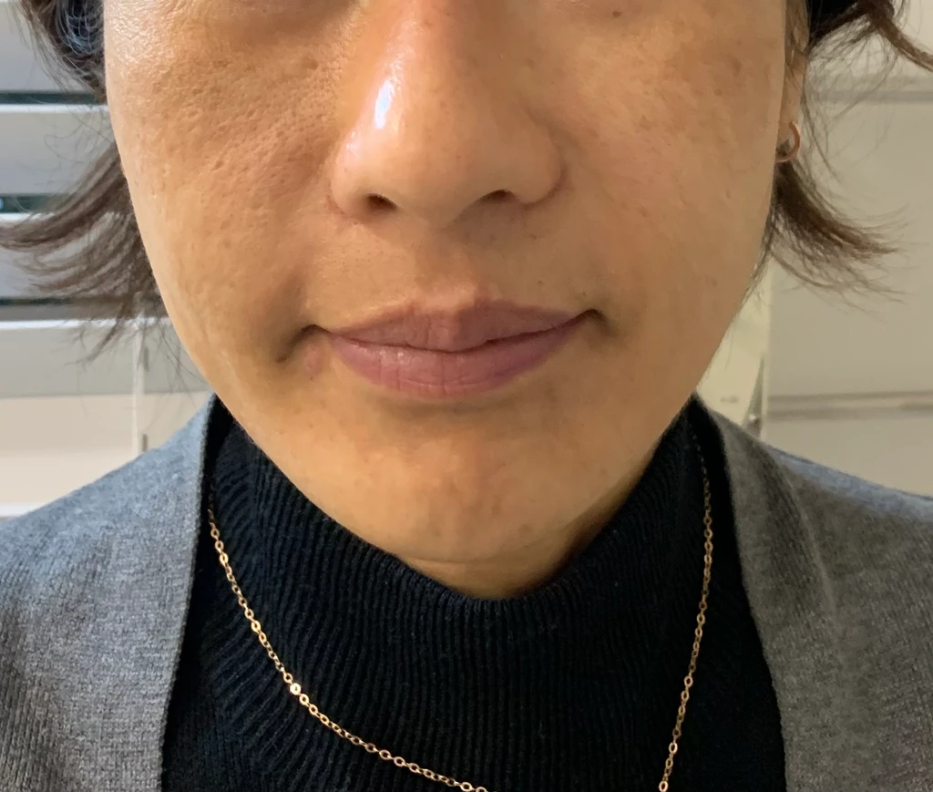 before_image