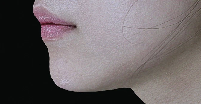 before_image