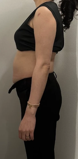 before_image
