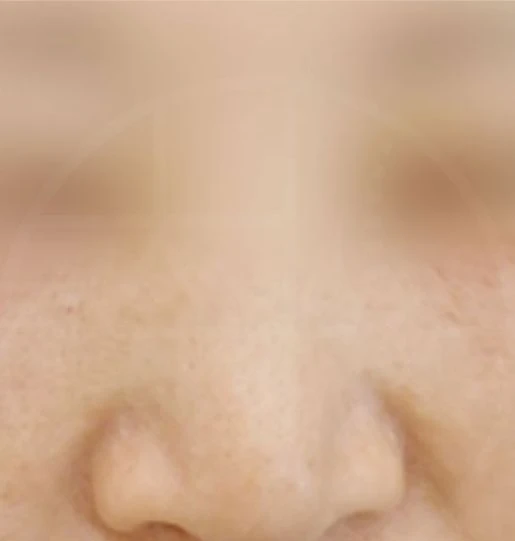 before_image