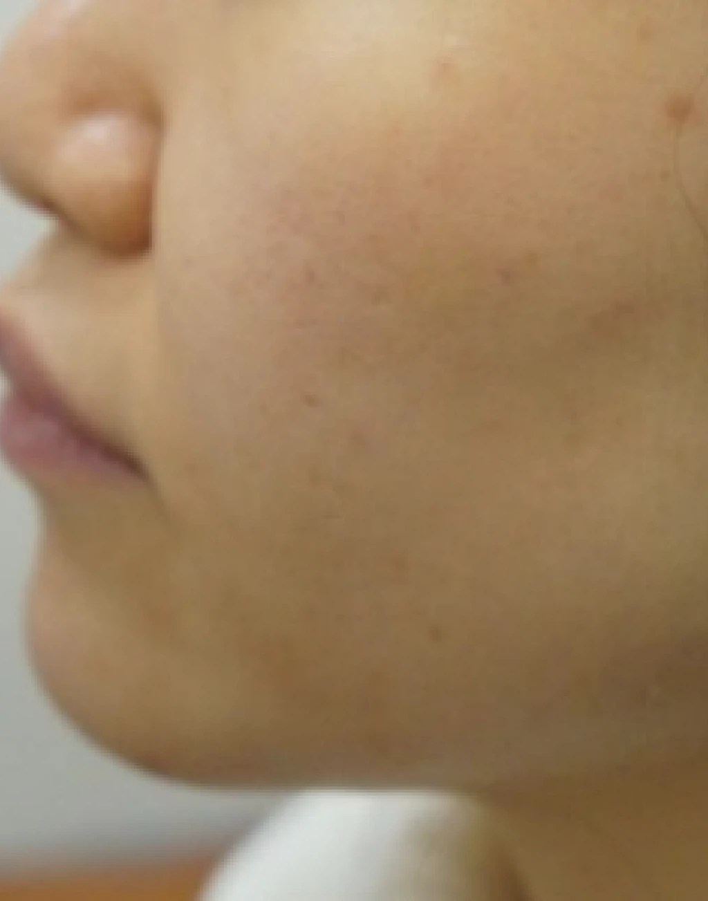 before_image