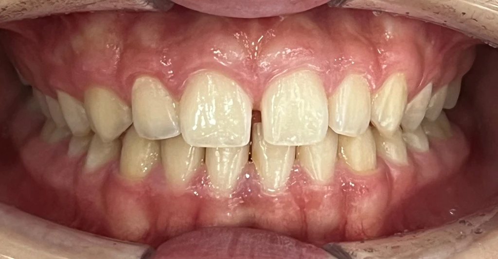 before_image