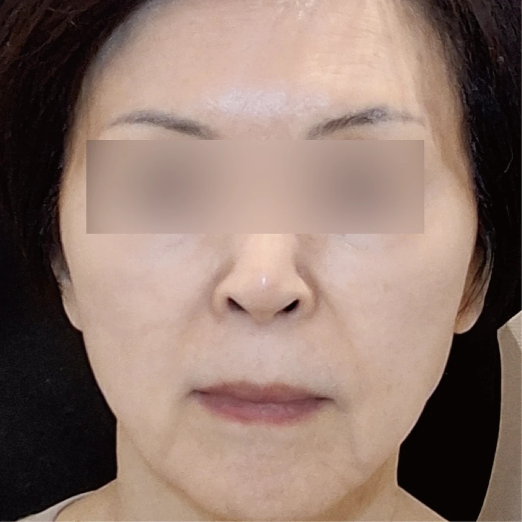 before_image