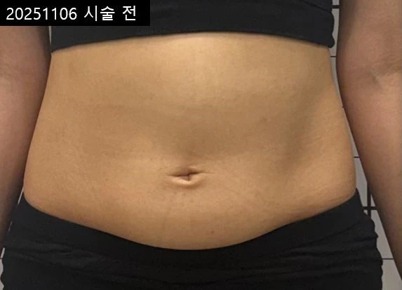 before_image