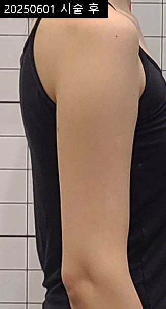 before_image