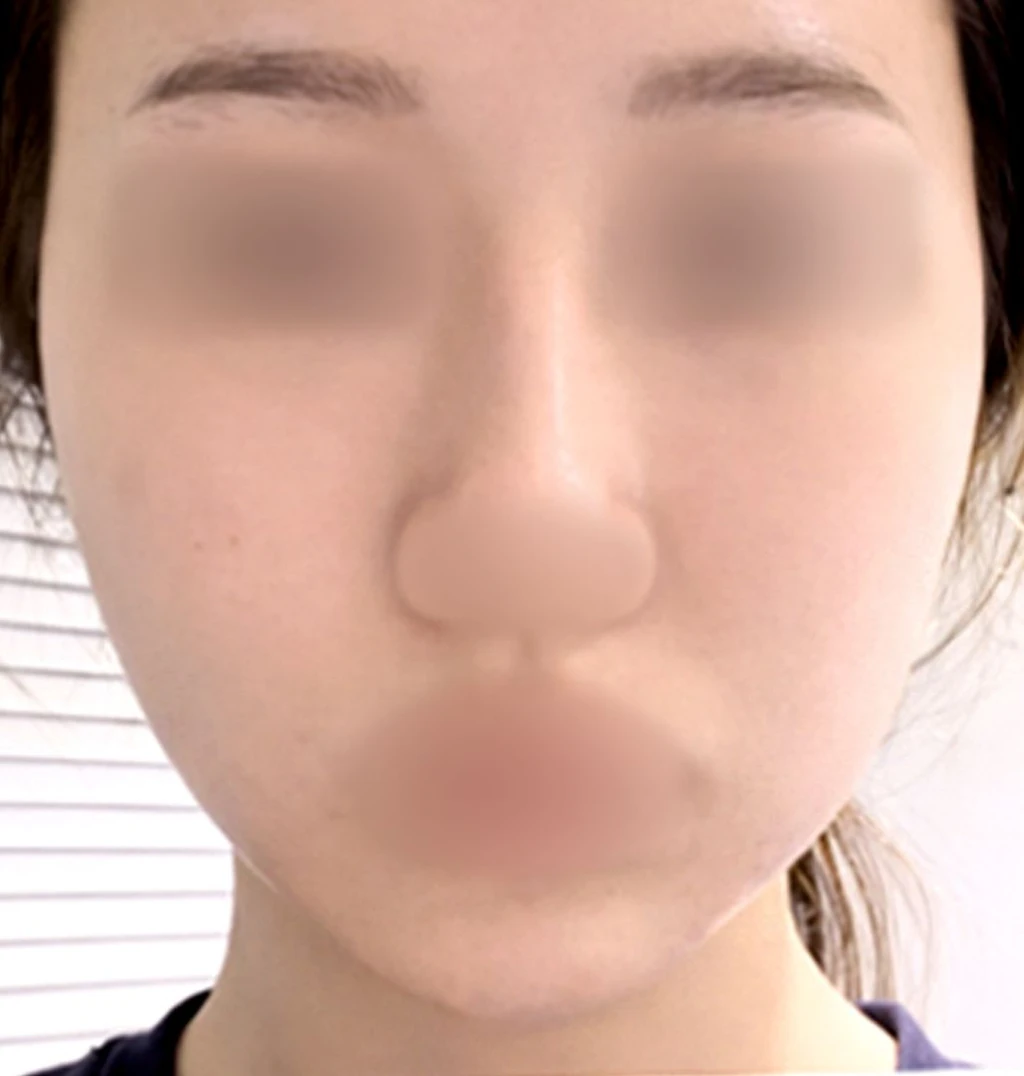before_image